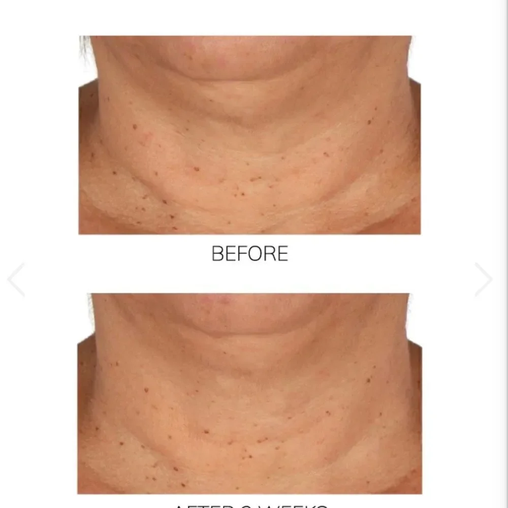 DIAMOND CONTOUR LIFTING ROSE QUARTZ NECK SERUM Firming Treatment + Youth…